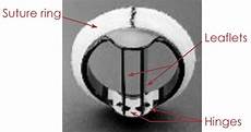 Ball Valves