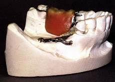 Dental Plaster