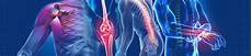 Orthopaedic Reconstruction Products