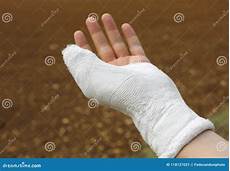 Plaster Hand