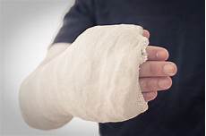 Plaster Of Paris