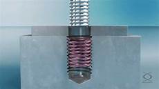 Screwlock