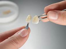 Zirconia Adhesive