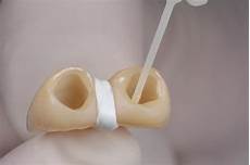 Zirconia Adhesive